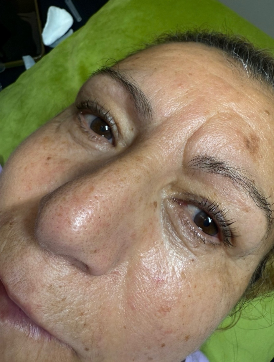 Licensed esthetician performing facial extraction Full Circle Beauty San Diego